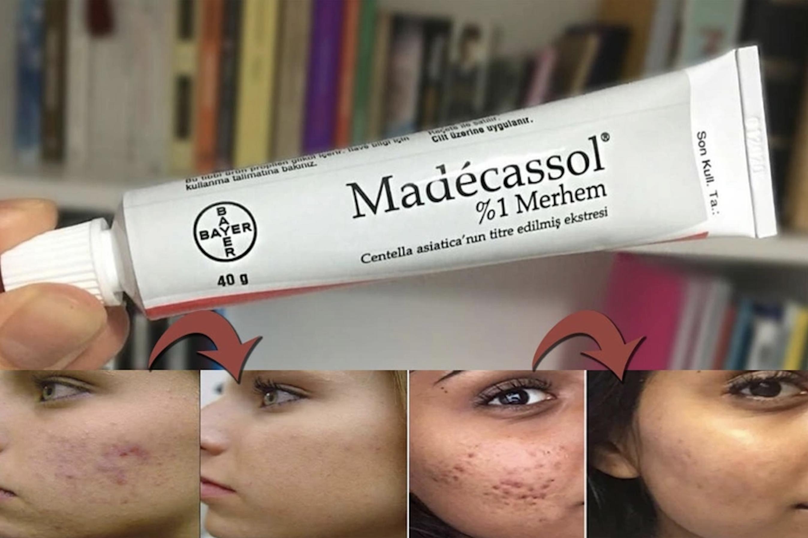 Madeca Sol MADECASSOL / МАДЕКАСОЛ КРЕМ ПРОТИВ БЕЛЕЗИ, РАНИ , ИЗГАРЯНИЯ И АКНЕ 40gr.